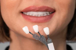 any risks with veneers in Dubai